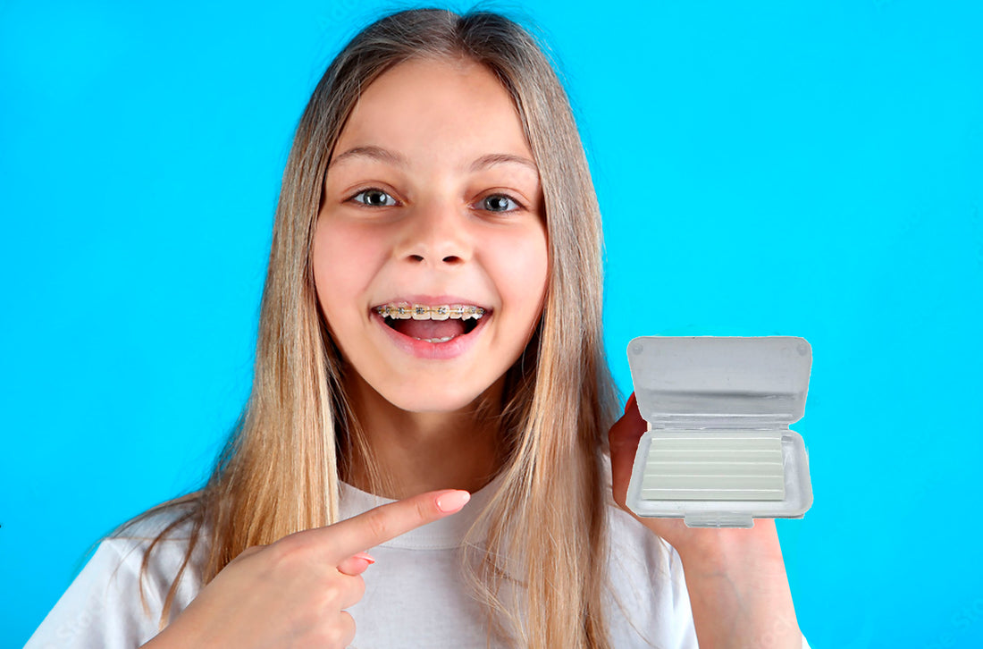 Say Goodbye to Discomfort with OrthoHero’s Braces Protective Wax – Ultimate Edition