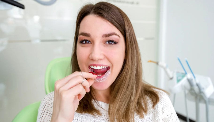 Invisalign aligner cleaning system kit for clear aligners